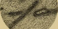 An illustration from A text-book of diseases of the nose and throat (1904)