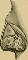 An illustration from A text-book of diseases of the nose and throat (1904)
