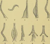 An illustration from A text-book of diseases of the nose and throat (1904)