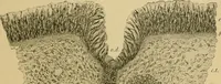 An illustration from A text-book of diseases of the nose and throat (1904)