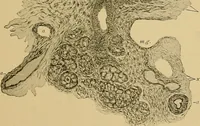 An illustration from A text-book of diseases of the nose and throat (1904)