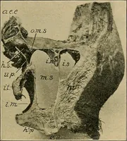 An illustration from A text-book of diseases of the nose and throat (1904)