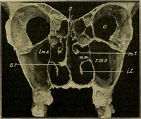 An illustration from A text-book of diseases of the nose and throat (1904)