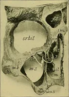 An illustration from A text-book of diseases of the nose and throat (1904)