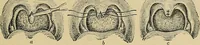 An illustration from A text-book of diseases of the nose and throat (1904)