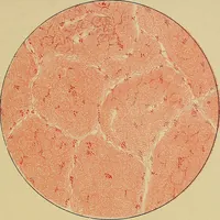 An illustration from A text-book of diseases of the nose and throat (1904)