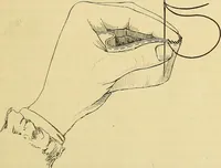 An illustration from A text-book of needlework, knitting and cutting out : with methods of teaching (1893)
