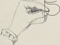 An illustration from A text-book of needlework, knitting, and cutting out : with methods of teaching (1893)