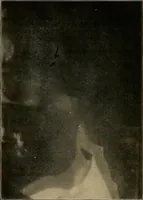 An illustration from A text-book of radiology (1915)