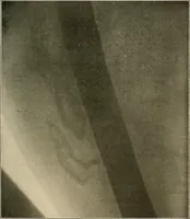 An illustration from A text-book of radiology (1915)