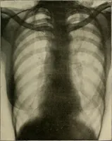 An illustration from A text-book of radiology (1915)