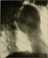 An illustration from A text-book of radiology (1915)