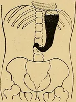 An illustration from A text-book of radiology (1915)