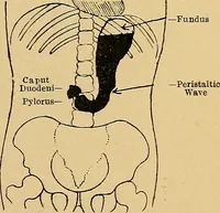 An illustration from A text-book of radiology (1915)