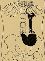 An illustration from A text-book of radiology (1915)