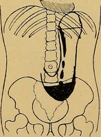 An illustration from A text-book of radiology (1915)