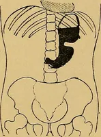 An illustration from A text-book of radiology (1915)