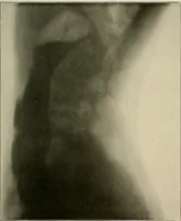 An illustration from A text-book of radiology (1915)