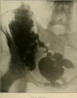An illustration from A text-book of radiology (1915)
