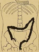 An illustration from A text-book of radiology (1915)