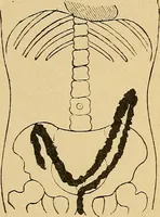 An illustration from A text-book of radiology (1915)