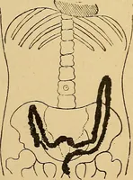 An illustration from A text-book of radiology (1915)