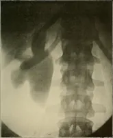 An illustration from A text-book of radiology (1915)