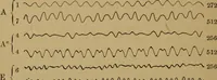 An illustration from A text-book on sound (1908)
