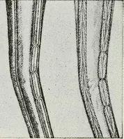 An illustration from Textiles and clothing, by Kate Heintz Watson (1914)