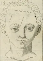 An illustration from Traicté povr la conservation de la santé, et svr la saignee de ce temps, et moyen de remedier aux maladies sans craincte de leur recheute : auec autres traictez necessaires pour toutes sortes de personnes, en façon & ordre non encores veus, & selon la doctrine des anciens medecins grecs, arabes, latins & françois : avgmenté d'vn Traicté de Galien, de l'alictement des malades : Apologie contre Iean Terud ... : Examen du liure intitulé Medecin charitable : Traicté de la physiognomie, auec les figures propres, qui sont au nombre de 53 ... (1650)