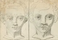 An illustration from Traicté povr la conservation de la santé, et svr la saignee de ce temps, et moyen de remedier aux maladies sans craincte de leur recheute : auec autres traictez necessaires pour toutes sortes de personnes, en façon & ordre non encores veus, & selon la doctrine des anciens medecins grecs, arabes, latins & françois : avgmenté d'vn Traicté de Galien, de l'alictement des malades : Apologie contre Iean Terud ... : Examen du liure intitulé Medecin charitable : Traicté de la physiognomie, auec les figures propres, qui sont au nombre de 53 ... (1650)