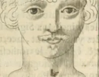 An illustration from Traicté povr la conservation de la santé, et svr la saignee de ce temps, et moyen de remedier aux maladies sans craincte de leur recheute : auec autres traictez necessaires pour toutes sortes de personnes, en façon & ordre non encores veus, & selon la doctrine des anciens medecins grecs, arabes, latins & françois : avgmenté d'vn Traicté de Galien, de l'alictement des malades : Apologie contre Iean Terud ... : Examen du liure intitulé Medecin charitable : Traicté de la physiognomie, auec les figures propres, qui sont au nombre de 53 ... (1650)