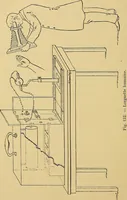 An illustration from Traité de radiographie médicale et scientifique : cours libre professé a l'écolepratique de la Faculté de Médecine de Paris, deuxième semestre de 1896-1897 (1897)