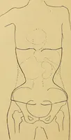 An illustration from Traité de radiographie médicale et scientifique : cours libre professé a l'écolepratique de la Faculté de Médecine de Paris, deuxième semestre de 1896-1897 (1897)