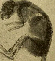 An illustration from Traité de radiographie médicale et scientifique : cours libre professé a l'écolepratique de la Faculté de Médecine de Paris, deuxième semestre de 1896-1897 (1897)
