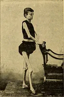 An illustration from Traité de radiographie médicale et scientifique : cours libre professé a l'écolepratique de la Faculté de Médecine de Paris, deuxième semestre de 1896-1897 (1897)