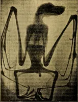 An illustration from Traité de radiographie médicale et scientifique : cours libre professé a l'écolepratique de la Faculté de Médecine de Paris, deuxième semestre de 1896-1897 (1897)