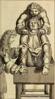 An illustration from Traite' de la lithotomie, ou, De l'extraction de la pierre, hors de la vessie : enrichy de figures necessaires pour representer la maniére de sonder, les instrumens propres, le malade dans l'operation : la ponction du perinée, & les differentes methodes de tirer la pierre : avec les appareils, les remedes preservatifs du calcul, & les medicamens pour les taillez (1686)