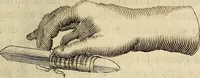 An illustration from Traite' de la lithotomie, ou, De l'extraction de la pierre, hors de la vessie : enrichy de figures necessaires pour representer la maniére de sonder, les instrumens propres, le malade dans l'operation : la ponction du perinée, & les differentes methodes de tirer la pierre : avec les appareils, les remedes preservatifs du calcul, & les medicamens pour les taillez (1686)