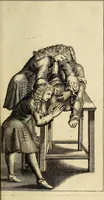 An illustration from Traite' de la lithotomie, ou, De l'extraction de la pierre, hors de la vessie : enrichy de figures necessaires pour representer la maniére de sonder, les instrumens propres, le malade dans l'operation : la ponction du perinée, & les differentes methodes de tirer la pierre : avec les appareils, les remedes preservatifs du calcul, & les medicamens pour les taillez (1686)