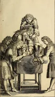 An illustration from Traite' de la lithotomie, ou, De l'extraction de la pierre, hors de la vessie : enrichy de figures necessaires pour representer la maniére de sonder, les instrumens propres, le malade dans l'operation : la ponction du perinée, & les differentes methodes de tirer la pierre : avec les appareils, les remedes preservatifs du calcul, & les medicamens pour les taillez (1686)