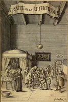 Picture 2 of 16 from Traite' de la lithotomie, ou, De l'extraction de la pierre, hors de la vessie : enrichy de figures necessaires pour representer la maniére de sonder, les instrumens propres, le malade dans l'operation : la ponction du perinée, & les differentes methodes de tirer la pierre : avec les appareils, les remedes preservatifs du calcul, & les medicamens pour les taillez (1686), leaf 6