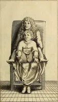 An illustration from Traite' de la lithotomie, ou, De l'extraction de la pierre, hors de la vessie : enrichy de figures necessaires pour representer la maniére de sonder, les instrumens propres, le malade dans l'operation : la ponction du perinée, & les differentes methodes de tirer la pierre : avec les appareils, les remedes preservatifs du calcul, & les medicamens pour les taillez (1686)