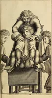An illustration from Traite' de la lithotomie, ou, De l'extraction de la pierre, hors de la vessie : enrichy de figures necessaires pour representer la maniére de sonder, les instrumens propres, le malade dans l'operation : la ponction du perinée, & les differentes methodes de tirer la pierre : avec les appareils, les remedes preservatifs du calcul, & les medicamens pour les taillez (1686)