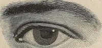 An illustration from A treatise on human nature and physiognomy (1882)