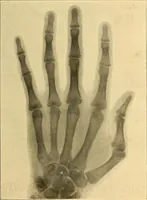 Picture 7 of 93 from Études biologiques sur les géants (1904), leaf 104