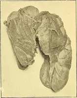 Picture 32 of 93 from Études biologiques sur les géants (1904), leaf 191