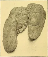 Picture 33 of 93 from Études biologiques sur les géants (1904), leaf 191