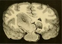 Picture 36 of 93 from Études biologiques sur les géants (1904), leaf 194
