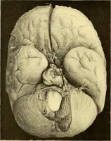 Picture 43 of 93 from Études biologiques sur les géants (1904), leaf 251